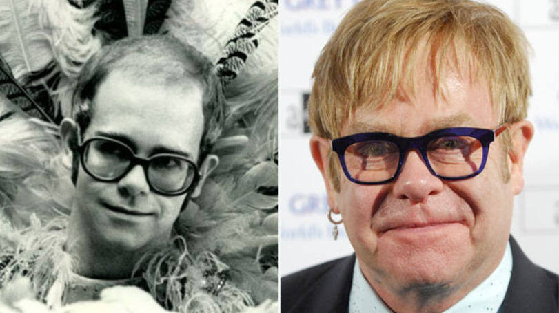 size_810_16_9_elton-john-ante-depois