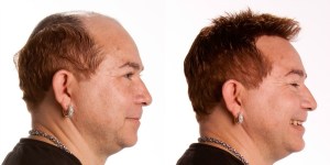 Apliques-de-Cabelos-para-Homens-9